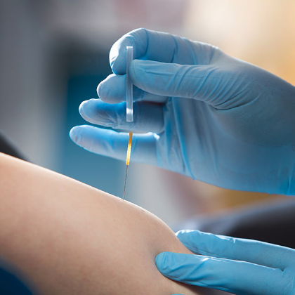 dry_needling_3